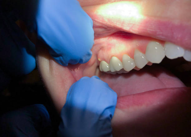 Best Emergency Cosmetic Dentistry in Marion, MS