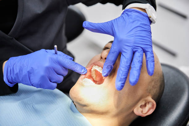 Best Emergency Dentist for Knocked-Out Tooth in Marion, MS